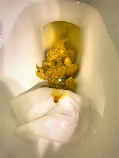 Faeces porn - eating feces (5,657 results)Report. eating feces. (5,657 results) Related searches disgusting anal eating shitty ass femdom toilet shiting on dick dirty shitty ass to mouth shitty asshole taking a dump poopy anal shitty panties human toilet japanese human toilet scatt shitty ass to mouth pooing shiting turd brown shower feces skat porn ...